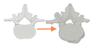 remodelacion-paget-sonzini