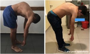 scheuermann-sonzini-001